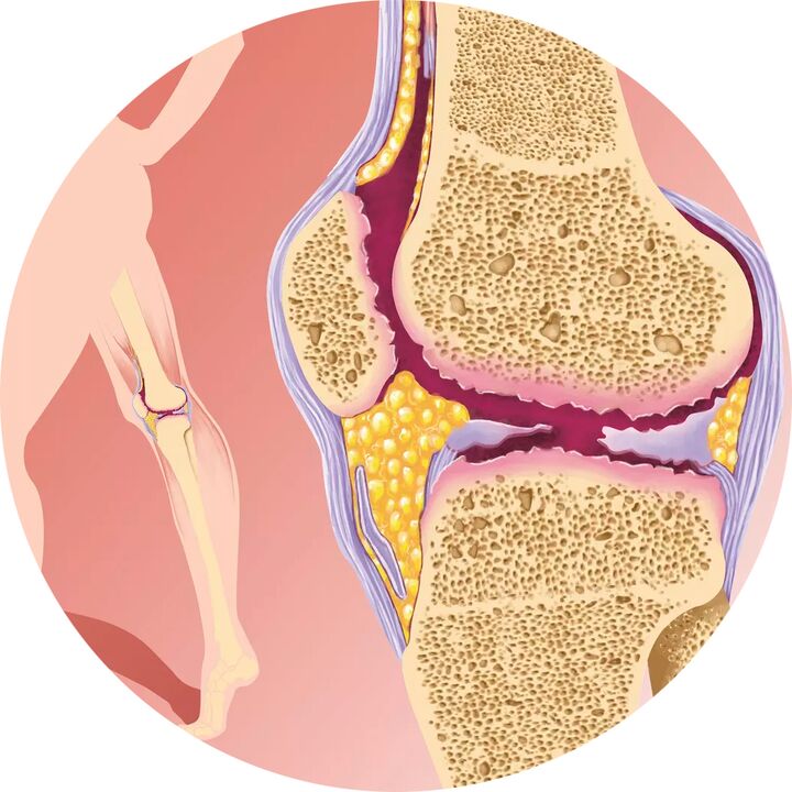 Hondroten - Podporuje pohyblivost kloubů